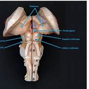 Image result for Brain Stem Model Posterior