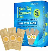 Image result for Skin Tat Removers