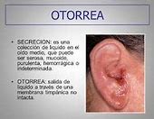 Image result for otorrea