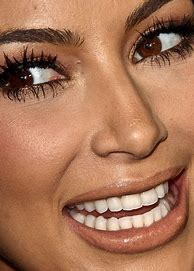 Image result for Gems On Kim Kardashian Teeth