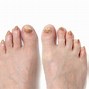 Image result for Ugly Toes