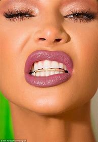 Image result for Kim Kardashian Teeth