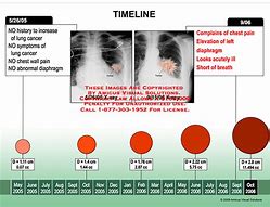 Image result for How Big Is 10 Cm Tumor