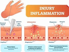 Image result for Inflammation Template