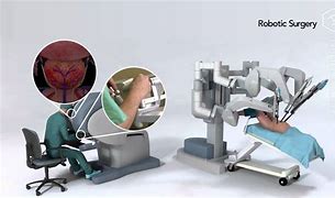 Image result for Robot Prostate Surgery