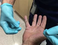 Image result for Fish Hook Removal with String