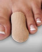 Image result for Overlapping Toes