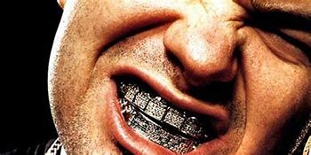 Image result for Grill Teeth Meme