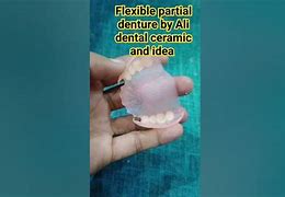 Image result for Flexible Partial Dentures