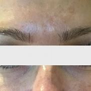 Image result for Vitamin C Serum Allergic Reaction