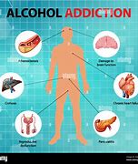 Image result for alcoholati