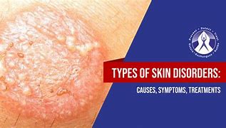 Image result for Pictures of Skin Conditions