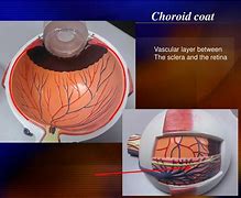 Image result for Choroid Coat