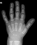 Image result for Weird X-rays