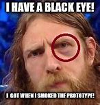 Image result for Black Eye Meme