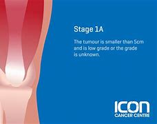 Image result for Sarcoma Pictures