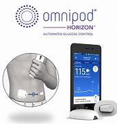 Image result for OmniPod 5 Cannula