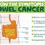 Image result for Smell of Bowel Cancer
