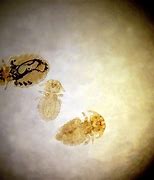 Image result for Lice On Dogs
