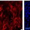 Image result for Tubulin Axon