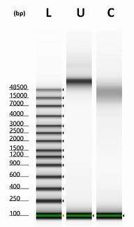 Image result for Hek 293 Host Cell Protein 2D Gel