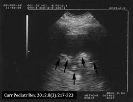 Image result for Shred Sign Radiology