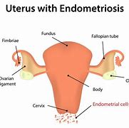 Image result for Endometrium