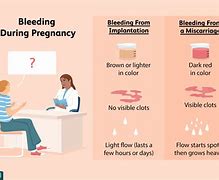 Image result for What Does a Miscarriage Blood Look Like