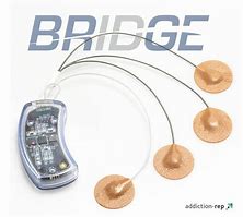 Image result for Bridge Device