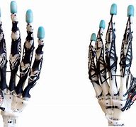 Image result for 3D Printing Prosthetic Limbs