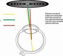 Image result for Corneal Curvature