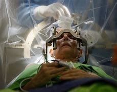 Image result for Brain Surgery Pic