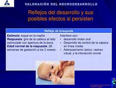 Image result for aderezamiento