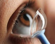 Image result for keratoconus contact lenses fitting