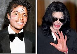 Image result for Michael Jackson Before He Bleached His Skin