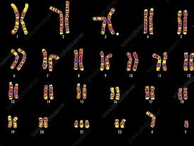 Image result for karyotype+down