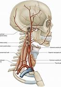 Image result for Carotid Artery Anatomy Diagram