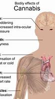Image result for Cannabis Side Effects
