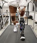 Image result for Robotic Prosthetic Leg