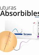 Image result for absorvible