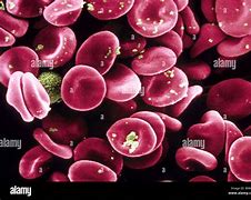 Image result for Red Blood Cells Microscope