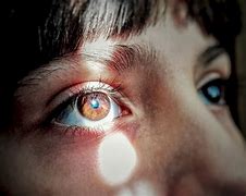 Image result for Bright Light in Eyes