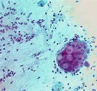 Image result for Chlamydia Trachomatis Bacteria Image Under Microscope