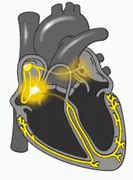 Image result for Yellow Heart Cartoon