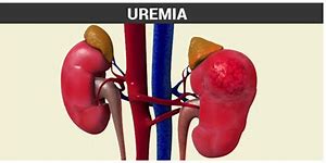 uremia 的图像结果
