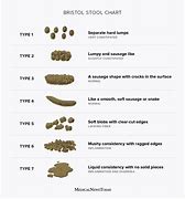 Image result for Shape of Your Poop