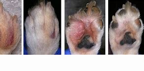 Image result for Home Cure Interdigital Cyst