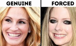 Image result for 3 Smile Types