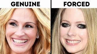 Image result for Smile Types
