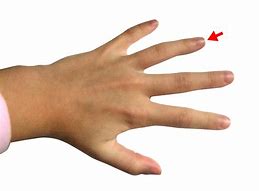 Image result for Hand Position for CPR